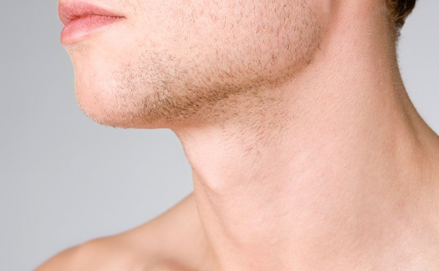 A photo of a male chin and neck.