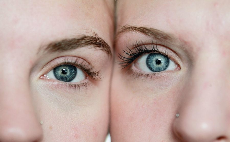 Two eyes are pressed close together. 